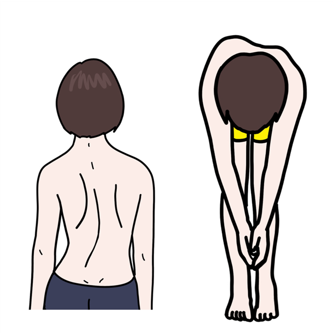 成長期に突発性側弯症を発症するケースが増え、学校では早期発見のため側弯症の検診が行われている