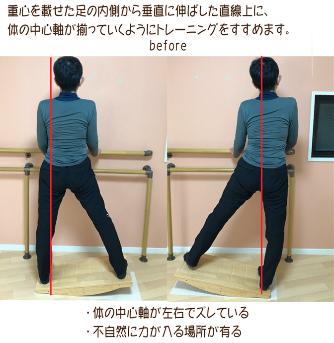 背骨の弯曲と回旋で、動きの悪くなっているアナトミー・トレインの筋膜を解しながら鍛えていく