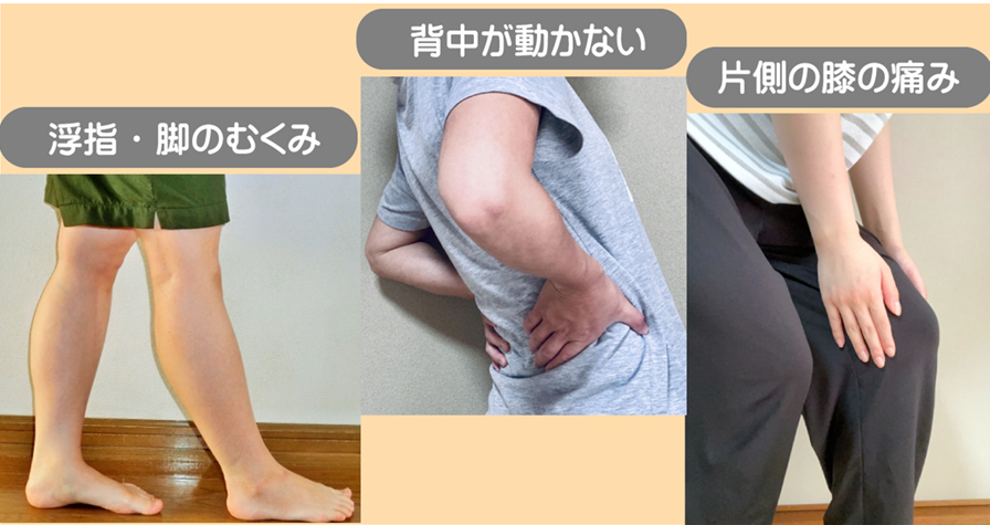 脊柱側弯症で背骨の動きが悪いと、背中を反らす丸める動きができない、足が上手く使えない、足関節が痛む原因になります